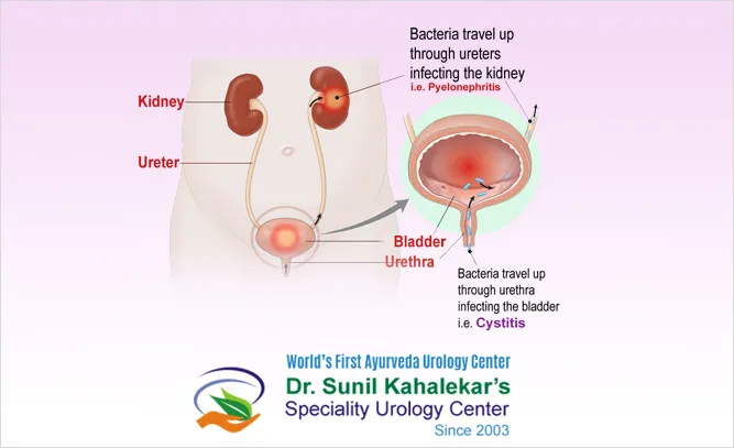 9889 antibiotics medication